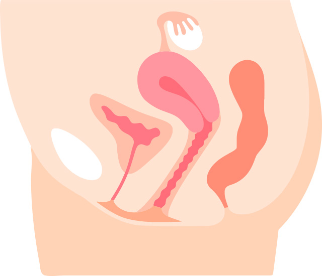 子宮内膜症ができやすい場所