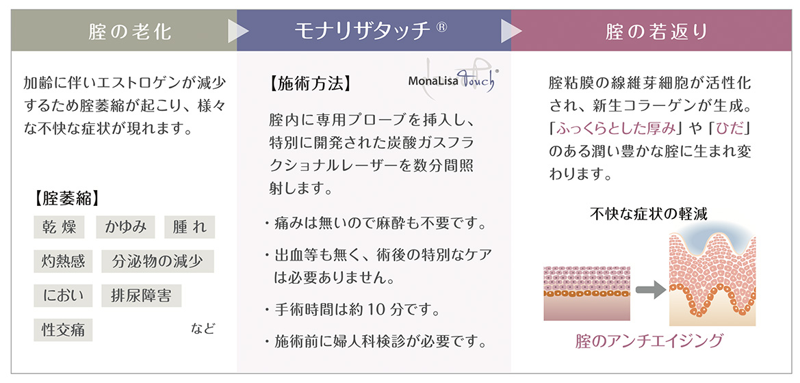 モナリザタッチ